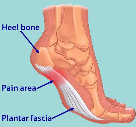 foot sole pain reasons